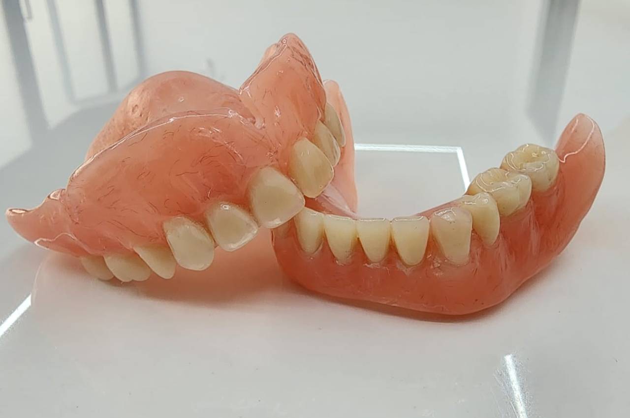 Dental Replacement