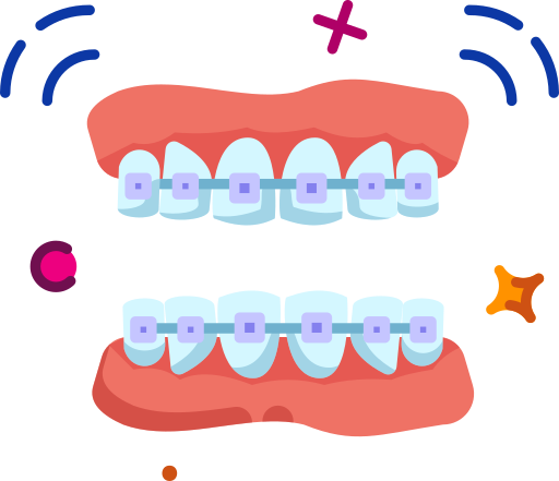 Teeth braces